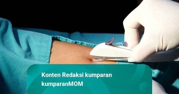 Mana Kontrasepsi yang Lebih Baik: KB Implan atau KB Suntik? Ini Penjelasannya!