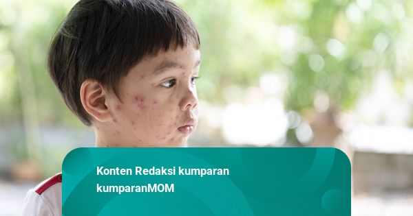 Mitos atau Fakta: Anak Kena Cacar dan Campak Dilarang Mandi?