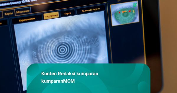 Dokter Mata: Minus Tinggi Bisa Bikin Katarak Datang Lebih Cepat