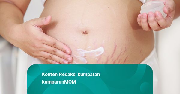 Stretch Mark Menghitam saat Hamil? Begini Cara Merawatnya agar Pudar!