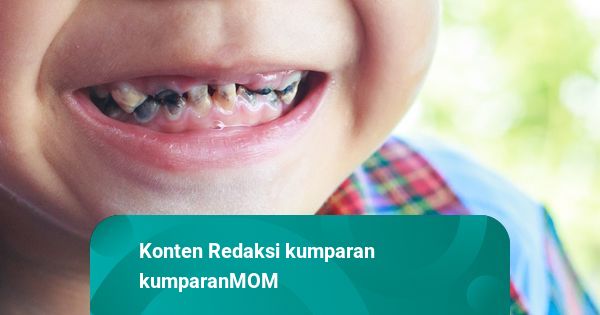 Kebiasaan Sepele Ini Bikin Anak di Malaysia Kehilangan 12 Gigi Susu
