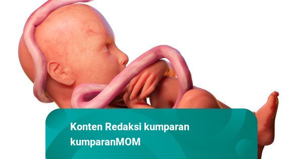 Lilitan Tali Pusat pada Bayi, Apakah Berbahaya?