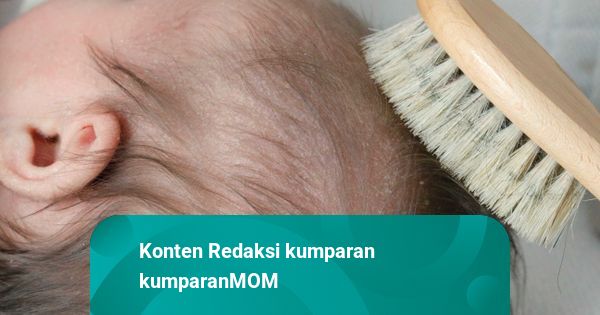 Muncul Kerak di Kepala Bayi, Perlukah Khawatir?