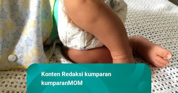 Bayi 17 Bulan Belum Bisa Berjalan, Ternyata Alami Knock Knee dan Eversi, Apa Itu