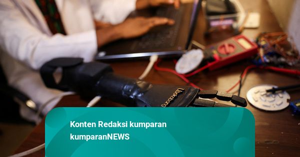 Foto: Kisah Kakak Beradik di Nigeria Ciptakan Lengan dan Kaki Bionik