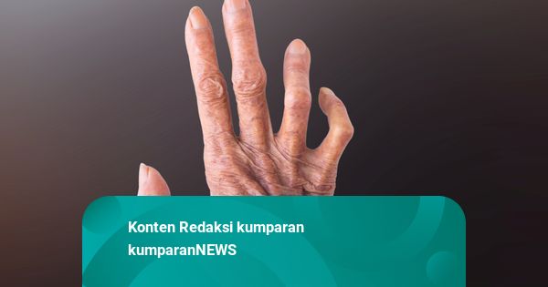 KBRI Bucharest Konfirmasi 2 WNI Idap Kusta, Dirawat karena Gejala Gatal-gatal