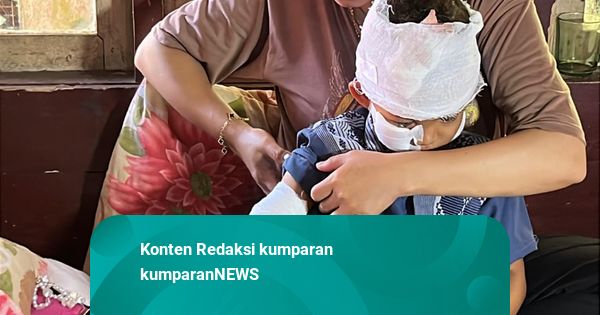 Teror Monyet Liar di Cianjur Berlanjut, Kini Anak 5 Tahun Jadi Korban