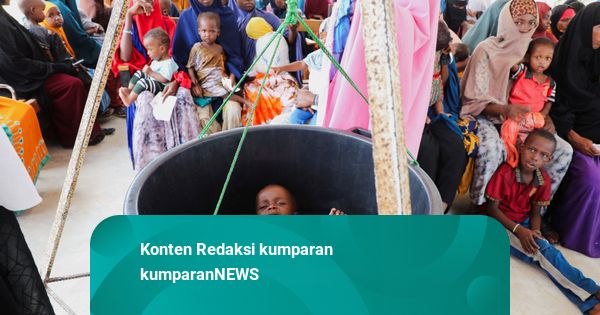 Foto: Imbas Perang AS-Iran, Anak Gizi Buruk di Somalia Krisis Pasokan Nutrisi