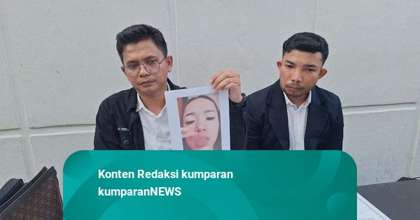 Diskon Besar Jadi Modus Operasi Kecantikan Ilegal Eks Finalis Puteri Indonesia