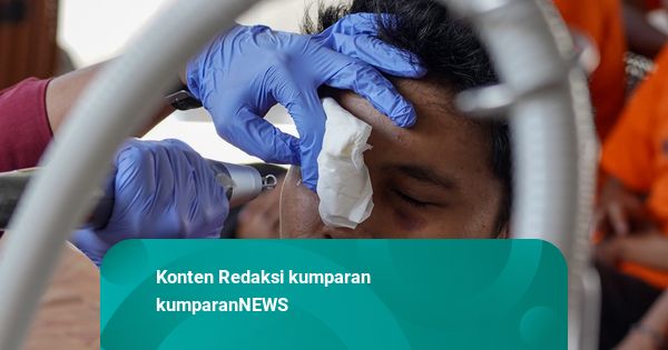 Foto: Warga Binaan Ikuti Program Hapus Tato di Makassar
