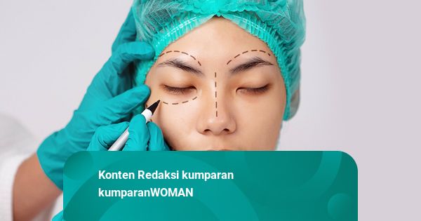 Ada Risiko di Balik Operasi Plastik Facelift, Ini Kata Dokter Bedah Estetika