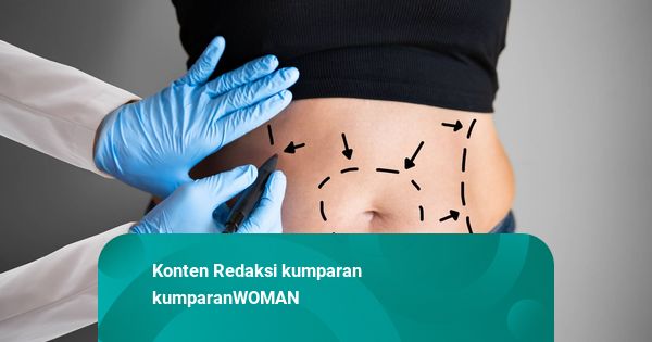 3 Hal yang Perlu Diperhatikan Sebelum Melakukan Prosedur Sedot Lemak