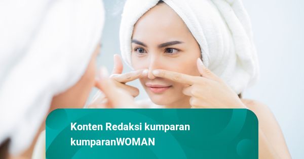 5 Cara Mengatasi Komedo di Dagu yang Tak Kunjung Hilang