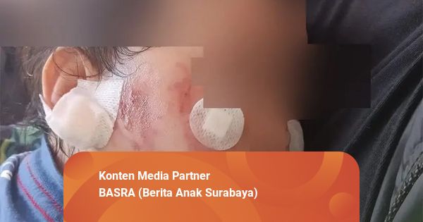 Balita Luka-luka di Daycare Surabaya, Komnas PA Soroti Legalitas Daycare