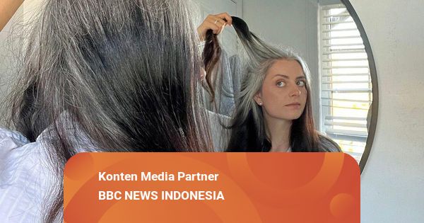 "Saya Berusia 14 Tahun, tapi Rambut Sudah Beruban"
