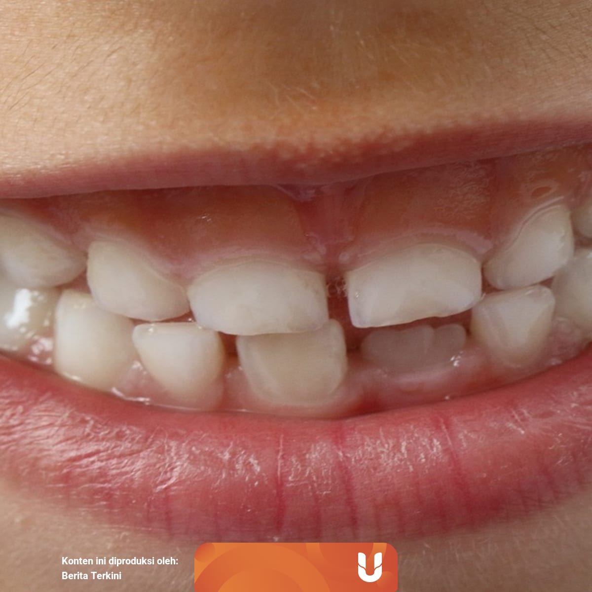 Arti Mimpi Gigi Copot Bagian Bawah Menurut Islam Primbon Dan Psikolog Kumparan Com