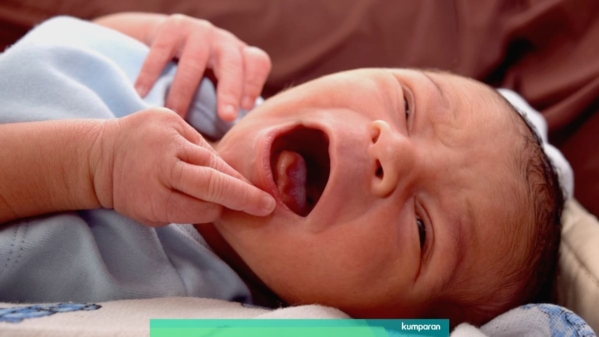 Tt Dan Lt Pada Bayi Insisi Tongue Tie Pada Bayi Bilamana Diperlukan Kumparan Com