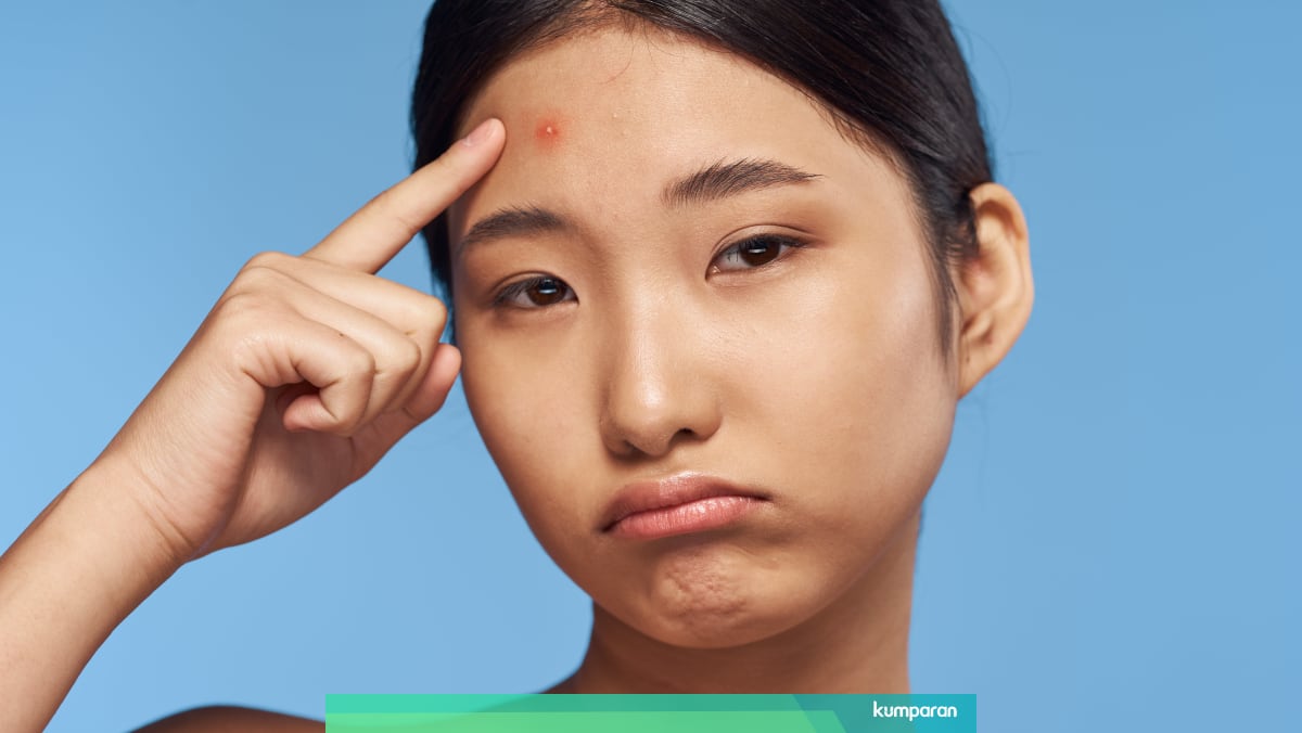 Tips Menghilangkan Jerawat Dengan Air Garam Kumparan Com Tips Menghilangkan Jerawat Dengan Air Garam Kumparan Com