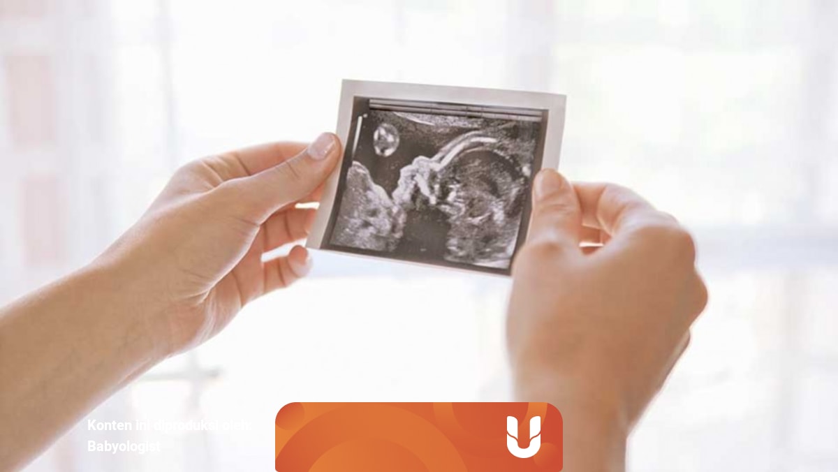 Usg 4d Perlu Tidak Kumparan 