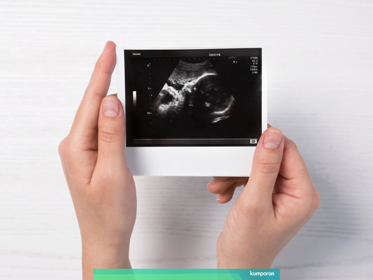 Cara Mengetahui Jenis Kelamin Bayi Di Dalam Kandungan Tanpa Usg Kumparan Com