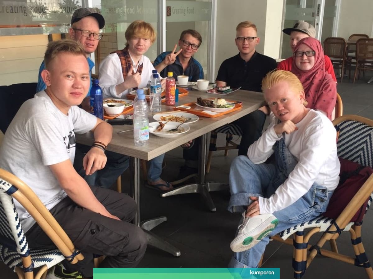 Berkenalan Dengan Komunitas Albino Indonesia Kumparan Com