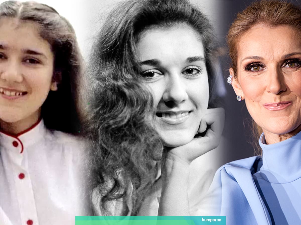 Melihat Perubahan Wajah Celine Dion Dari Masa Ke Masa Kumparan Com