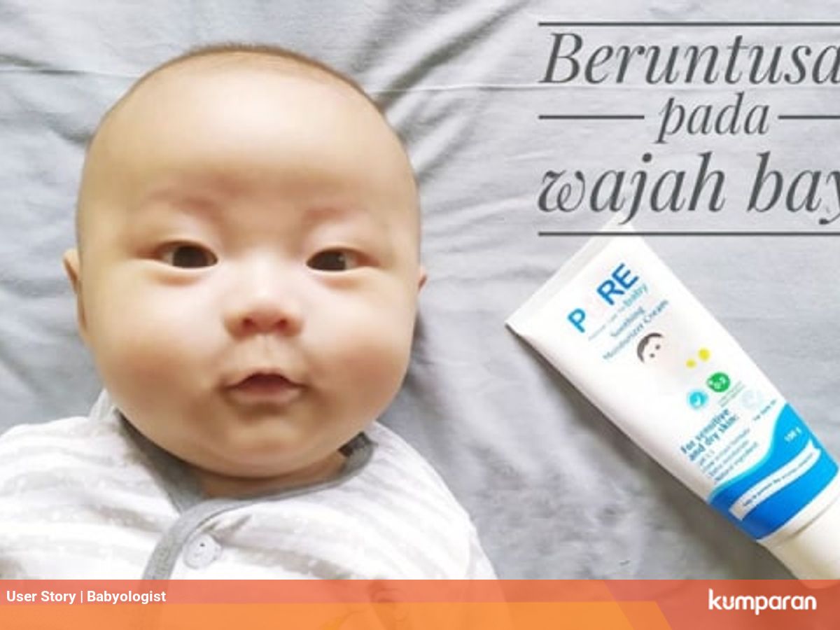 Mengatasi Wajah Bayi Yang Beruntusan Kumparan Com
