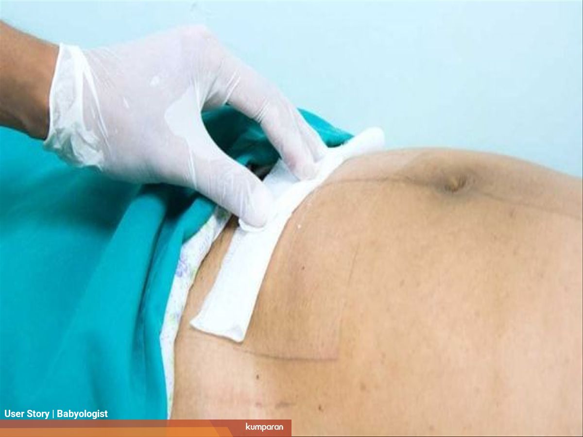 Ternyata Operasi Caesar Tidak Semenakutkan Itu Kumparan Com