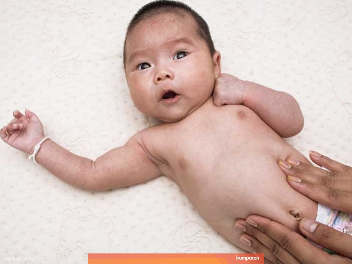 Ciri Ciri Bayi Kembung Penyebab Dan Cara Mengatasinya Kumparan Com