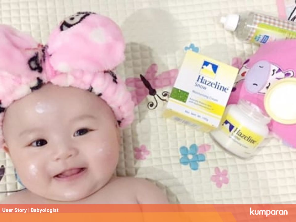 Tips Menghilangkan Bintik Bintik Merah Di Muka Bayi Kumparan Com