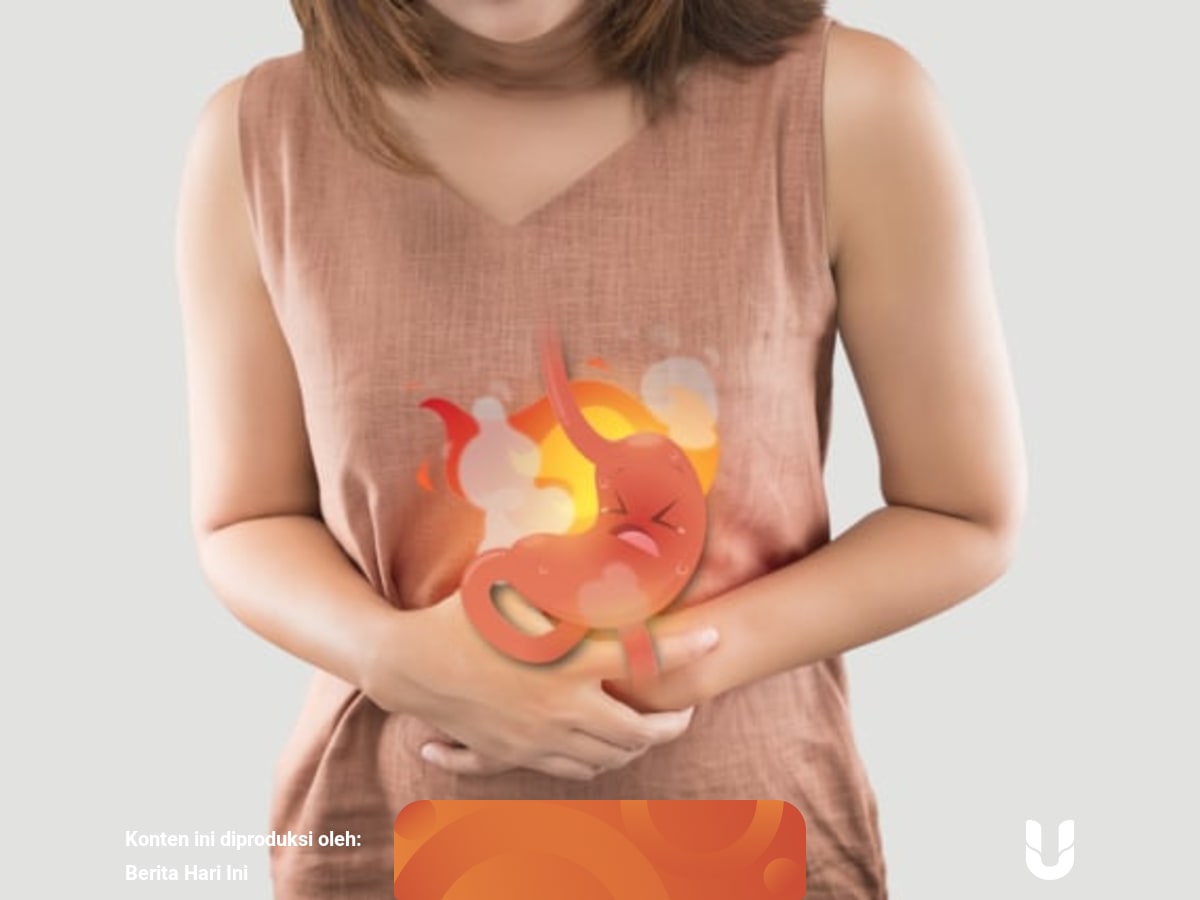 Atasi Keluhan Penyakit Asam Lambung Dengan Omeprazole Kumparan Com