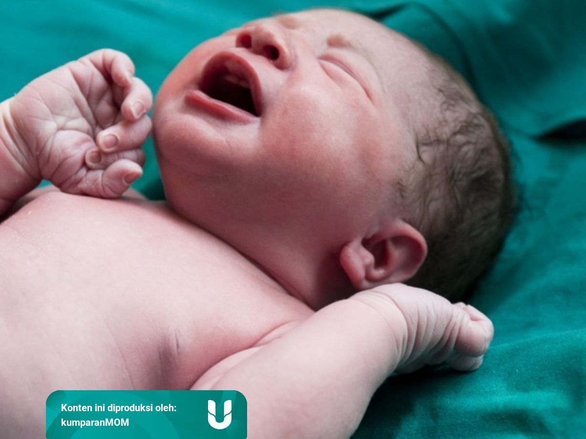 7 Pemeriksaan Yang Dilakukan Dokter Sesaat Setelah Bayi Lahir Kumparan Com