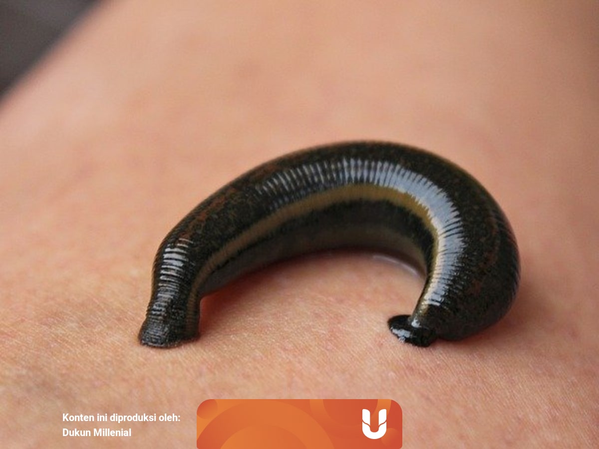 3 Arti Mimpi Digigit Lintah Kumparan Com