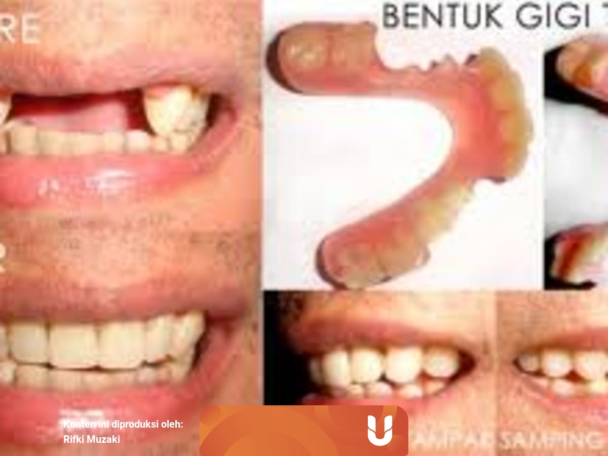 Ahli Gigi Jabodetabek Terima Panggilan Termurah Di Jakarta Bogor Depok Tangerang Bekasi Kumparan 