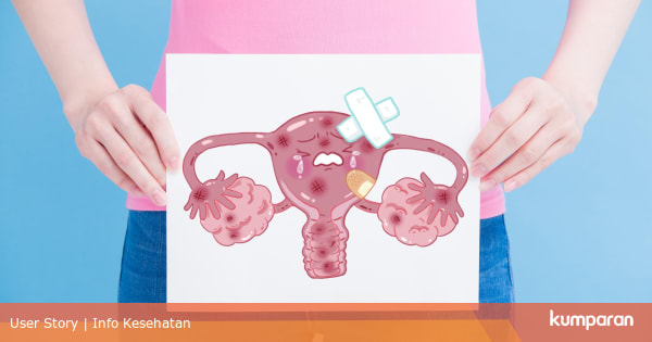 Apa Perbedaan Miom Kista Kitabisa Com Apa Perbedaan Miom Kista Kitabisa Com