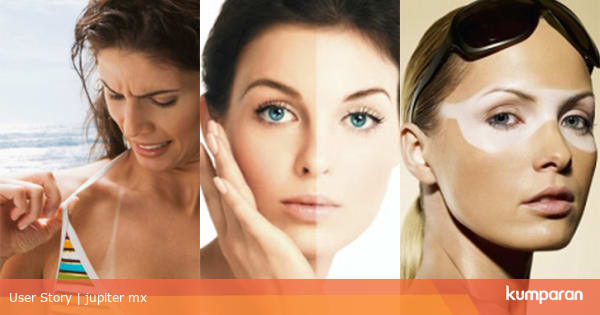 Obat Kulit Belang Paling Ampuh Dan Aman Tanpa Efek Samping Kumparan Com