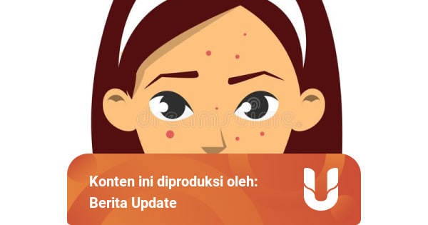 Cara Menghilangkan Jerawat Meradang - kumparan.com