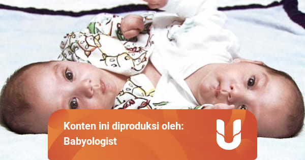 Bayi Kembar Siam, Dapat Dicegah atau Tidak Ya? - kumparan.com
